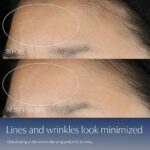 Advanced Night Repair Face Serum with Hyaluronic Acid & Peptides, Multi-Recovery Complex, 1.7oz - Image 3
